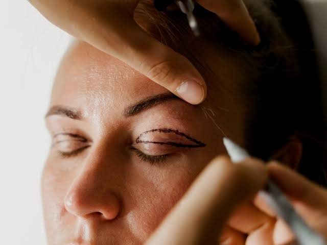 Blefaroplastia: O segredo para rejuvenescer o olhar! Blefaroplastia: O segredo para rejuvenescer o olhar!